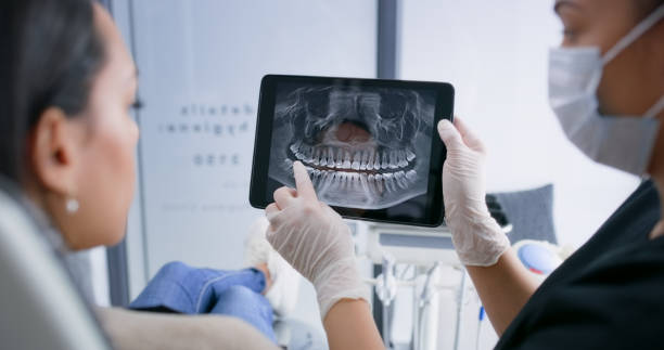Licensed Teeth Whitening service in Hoffman Estates, IL - Smile Center Dentistry